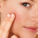 ত্বকে লালচে র্যাশ ওঠার ৭টি কারণ