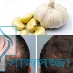 রসুনের রসে গজাবে টাক মাথায় চুল!