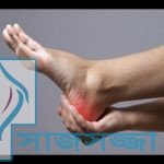 গোড়ালি ব্যাথা?